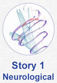 Button to story 1